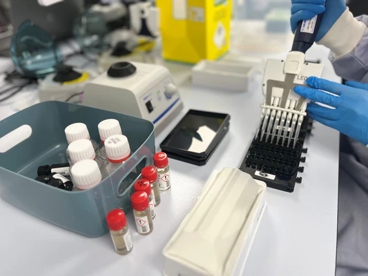 Laboratory technician using a multi-channel pipette to process food intolerance test samples in an ISO-accredited UK lab